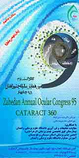 _POSTER Zahedan Annual Ocular Congress 95 CATARACT 360