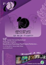 _POSTER 10th Iranian Oral, Maxillofacial Radiology Congress